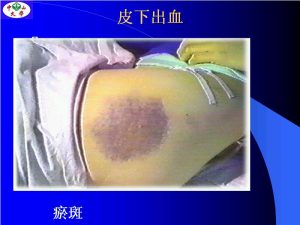 中山大学《健康评估（二）》42讲教学视频下载 - 教学视频下载中医教学-中医资料-中医医案-中医针灸-古籍珍本-中医基础-中医经典-中医-名家学术-中医男科-疾病专治-经方论治-名族医药-中医方剂-中药本草-中医拔罐-中医刮痧-推拿按摩-中医内科-中西结合-中医妇科-中医皮肤-中医医话-中医外科-中医儿科-中医儿科-海外中医-特色疗法-中医骨伤-中医四诊-中医养生阁