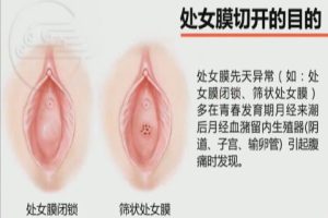 湖北医药学院《妇产科实践》27集 - 教学视频下载中医教学-中医资料-中医医案-中医针灸-古籍珍本-中医基础-中医经典-中医-名家学术-中医男科-疾病专治-经方论治-名族医药-中医方剂-中药本草-中医拔罐-中医刮痧-推拿按摩-中医内科-中西结合-中医妇科-中医皮肤-中医医话-中医外科-中医儿科-中医儿科-海外中医-特色疗法-中医骨伤-中医四诊-中医养生阁