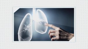 呼吸系统疾病(内科学微课)20集 - 教学视频下载中医教学-中医资料-中医医案-中医针灸-古籍珍本-中医基础-中医经典-中医-名家学术-中医男科-疾病专治-经方论治-名族医药-中医方剂-中药本草-中医拔罐-中医刮痧-推拿按摩-中医内科-中西结合-中医妇科-中医皮肤-中医医话-中医外科-中医儿科-中医儿科-海外中医-特色疗法-中医骨伤-中医四诊-中医养生阁