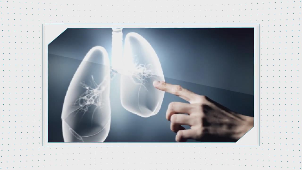 呼吸系统疾病(内科学微课)20集 - 教学视频下载 - 中医养生阁中医教学-中医资料-中医医案-中医针灸-古籍珍本-中医基础-中医经典-中医-名家学术-中医男科-疾病专治-经方论治-名族医药-中医方剂-中药本草-中医拔罐-中医刮痧-推拿按摩-中医内科-中西结合-中医妇科-中医皮肤-中医医话-中医外科-中医儿科-中医儿科-海外中医-特色疗法-中医骨伤-中医四诊-中医养生阁