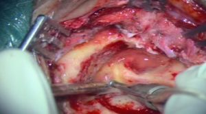 《耳鼻喉头颈外科学》47节 - 教学视频下载中医教学-中医资料-中医医案-中医针灸-古籍珍本-中医基础-中医经典-中医-名家学术-中医男科-疾病专治-经方论治-名族医药-中医方剂-中药本草-中医拔罐-中医刮痧-推拿按摩-中医内科-中西结合-中医妇科-中医皮肤-中医医话-中医外科-中医儿科-中医儿科-海外中医-特色疗法-中医骨伤-中医四诊-中医养生阁