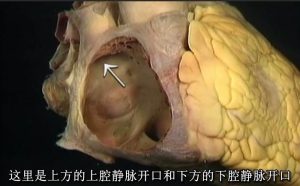 艾氏人体解剖 - 教学视频下载中医教学-中医资料-中医医案-中医针灸-古籍珍本-中医基础-中医经典-中医-名家学术-中医男科-疾病专治-经方论治-名族医药-中医方剂-中药本草-中医拔罐-中医刮痧-推拿按摩-中医内科-中西结合-中医妇科-中医皮肤-中医医话-中医外科-中医儿科-中医儿科-海外中医-特色疗法-中医骨伤-中医四诊-中医养生阁