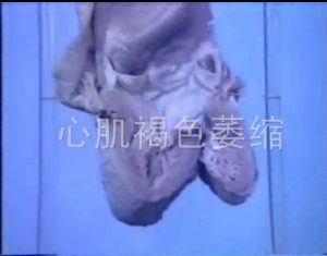 《病理学素材》131节 - 教学视频下载中医教学-中医资料-中医医案-中医针灸-古籍珍本-中医基础-中医经典-中医-名家学术-中医男科-疾病专治-经方论治-名族医药-中医方剂-中药本草-中医拔罐-中医刮痧-推拿按摩-中医内科-中西结合-中医妇科-中医皮肤-中医医话-中医外科-中医儿科-中医儿科-海外中医-特色疗法-中医骨伤-中医四诊-中医养生阁