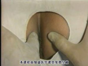 广州中医药大学《中医外科学》32集教学视频下载 - 教学视频下载中医教学-中医资料-中医医案-中医针灸-古籍珍本-中医基础-中医经典-中医-名家学术-中医男科-疾病专治-经方论治-名族医药-中医方剂-中药本草-中医拔罐-中医刮痧-推拿按摩-中医内科-中西结合-中医妇科-中医皮肤-中医医话-中医外科-中医儿科-中医儿科-海外中医-特色疗法-中医骨伤-中医四诊-中医养生阁