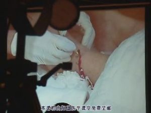 董氏针灸刺血班 - 教学视频下载中医教学-中医资料-中医医案-中医针灸-古籍珍本-中医基础-中医经典-中医-名家学术-中医男科-疾病专治-经方论治-名族医药-中医方剂-中药本草-中医拔罐-中医刮痧-推拿按摩-中医内科-中西结合-中医妇科-中医皮肤-中医医话-中医外科-中医儿科-中医儿科-海外中医-特色疗法-中医骨伤-中医四诊-中医养生阁