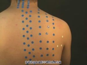 董氏针灸穴位 - 教学视频下载中医教学-中医资料-中医医案-中医针灸-古籍珍本-中医基础-中医经典-中医-名家学术-中医男科-疾病专治-经方论治-名族医药-中医方剂-中药本草-中医拔罐-中医刮痧-推拿按摩-中医内科-中西结合-中医妇科-中医皮肤-中医医话-中医外科-中医儿科-中医儿科-海外中医-特色疗法-中医骨伤-中医四诊-中医养生阁