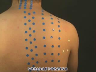 董氏针灸穴位 - 教学视频下载 - 中医养生阁中医教学-中医资料-中医医案-中医针灸-古籍珍本-中医基础-中医经典-中医-名家学术-中医男科-疾病专治-经方论治-名族医药-中医方剂-中药本草-中医拔罐-中医刮痧-推拿按摩-中医内科-中西结合-中医妇科-中医皮肤-中医医话-中医外科-中医儿科-中医儿科-海外中医-特色疗法-中医骨伤-中医四诊-中医养生阁