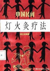 中国民间灯火灸疗法PDF电子书下载中医教学-中医资料-中医医案-中医针灸-古籍珍本-中医基础-中医经典-中医-名家学术-中医男科-疾病专治-经方论治-名族医药-中医方剂-中药本草-中医拔罐-中医刮痧-推拿按摩-中医内科-中西结合-中医妇科-中医皮肤-中医医话-中医外科-中医儿科-中医儿科-海外中医-特色疗法-中医骨伤-中医四诊-中医养生阁