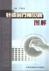 针灸治疗常见病图解PDF电子书下载中医教学-中医资料-中医医案-中医针灸-古籍珍本-中医基础-中医经典-中医-名家学术-中医男科-疾病专治-经方论治-名族医药-中医方剂-中药本草-中医拔罐-中医刮痧-推拿按摩-中医内科-中西结合-中医妇科-中医皮肤-中医医话-中医外科-中医儿科-中医儿科-海外中医-特色疗法-中医骨伤-中医四诊-中医养生阁