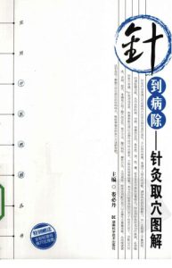 针到病除 针灸取穴图解PDF电子书下载中医教学-中医资料-中医医案-中医针灸-古籍珍本-中医基础-中医经典-中医-名家学术-中医男科-疾病专治-经方论治-名族医药-中医方剂-中药本草-中医拔罐-中医刮痧-推拿按摩-中医内科-中西结合-中医妇科-中医皮肤-中医医话-中医外科-中医儿科-中医儿科-海外中医-特色疗法-中医骨伤-中医四诊-中医养生阁