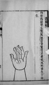 针灸大成 32PDF电子书下载中医教学-中医资料-中医医案-中医针灸-古籍珍本-中医基础-中医经典-中医-名家学术-中医男科-疾病专治-经方论治-名族医药-中医方剂-中药本草-中医拔罐-中医刮痧-推拿按摩-中医内科-中西结合-中医妇科-中医皮肤-中医医话-中医外科-中医儿科-中医儿科-海外中医-特色疗法-中医骨伤-中医四诊-中医养生阁