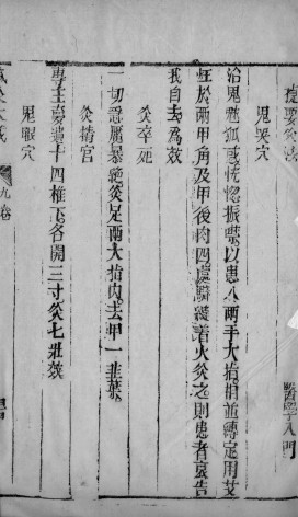 针灸大成 27PDF电子书下载 - 中医养生阁中医教学-中医资料-中医医案-中医针灸-古籍珍本-中医基础-中医经典-中医-名家学术-中医男科-疾病专治-经方论治-名族医药-中医方剂-中药本草-中医拔罐-中医刮痧-推拿按摩-中医内科-中西结合-中医妇科-中医皮肤-中医医话-中医外科-中医儿科-中医儿科-海外中医-特色疗法-中医骨伤-中医四诊-中医养生阁